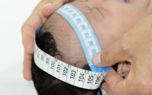 Acolhimento aos recém-nascidos com microcefalia é o foco da capacitação promovida pela Sesau na próxima segunda-feira (4).