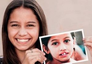 14202627032017_sorriso